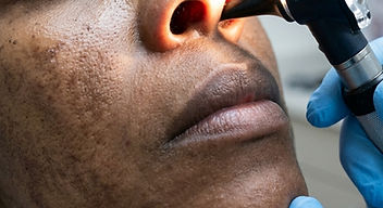 Managing Sinusitis: What You Can Do at Home