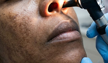 Nasal examination with an otoscope