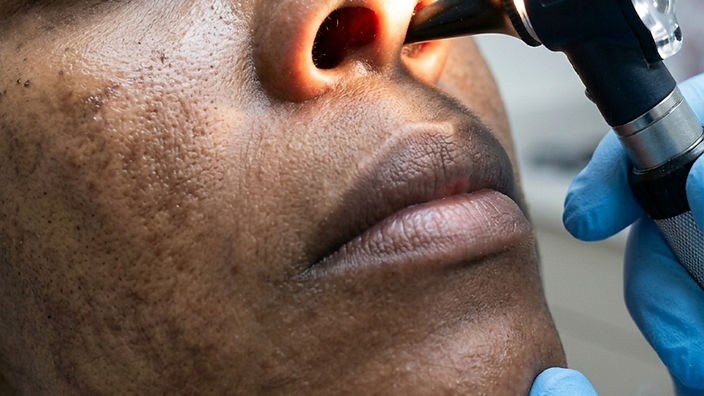 Managing Sinusitis: What You Can Do at Home