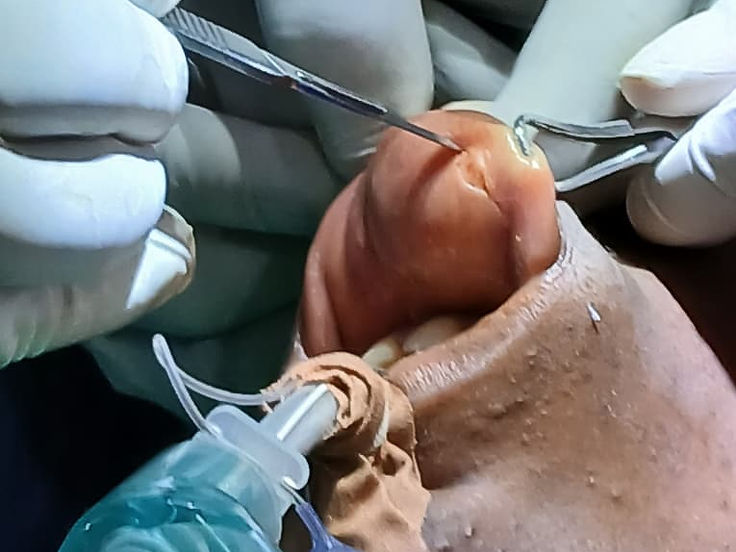 ENT minor procedure at Owerri ENT Specialists Clinic