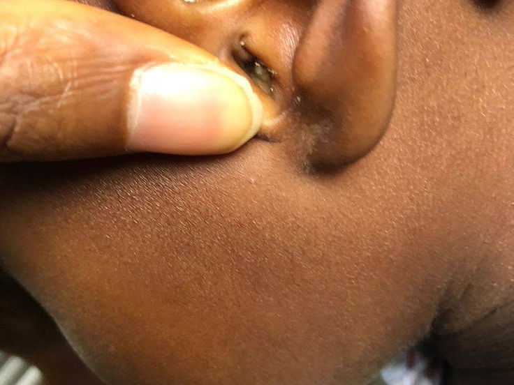 Close-up ear examination at Owerri ENT Specialists Clinic
