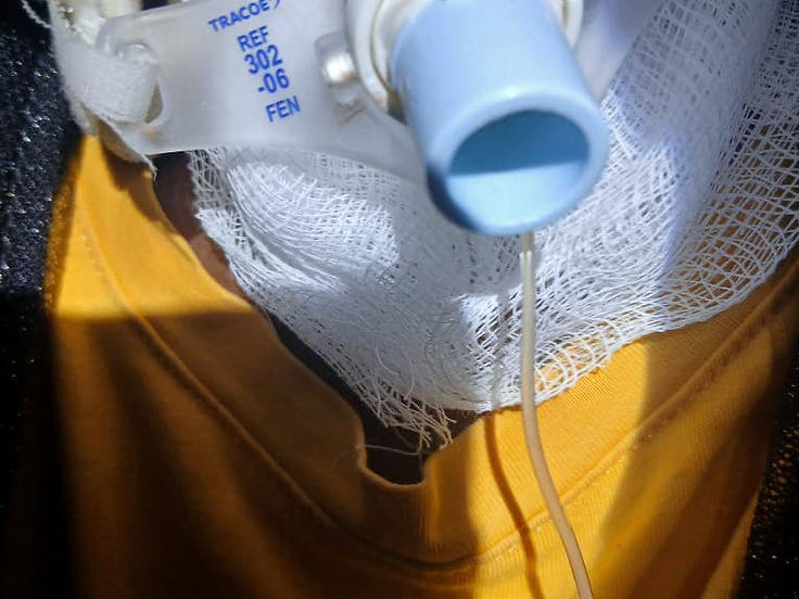 Tracheostomy care at Owerri ENT Specialists Clinic
