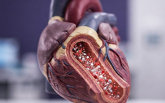 Understanding Oxidized LDL (oxLDL): Why It Matters for Heart Health
