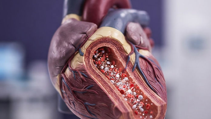 Understanding Oxidized LDL (oxLDL): Why It Matters for Heart Health
