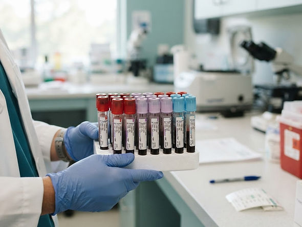 496 HEMOGLOBIN A1C