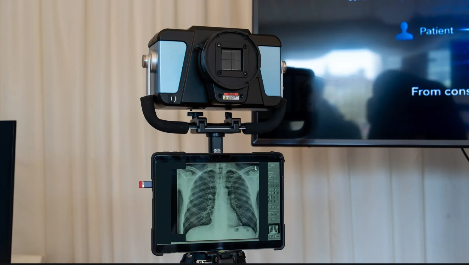 Portable imaging unit and a tablet displaying an example radiograph; on-screen annotations have been obscured.