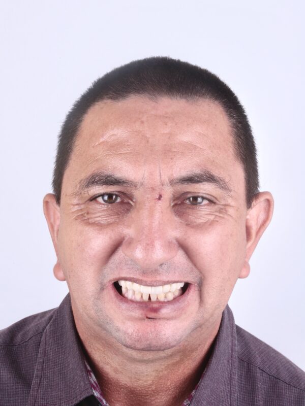 Resultado 2